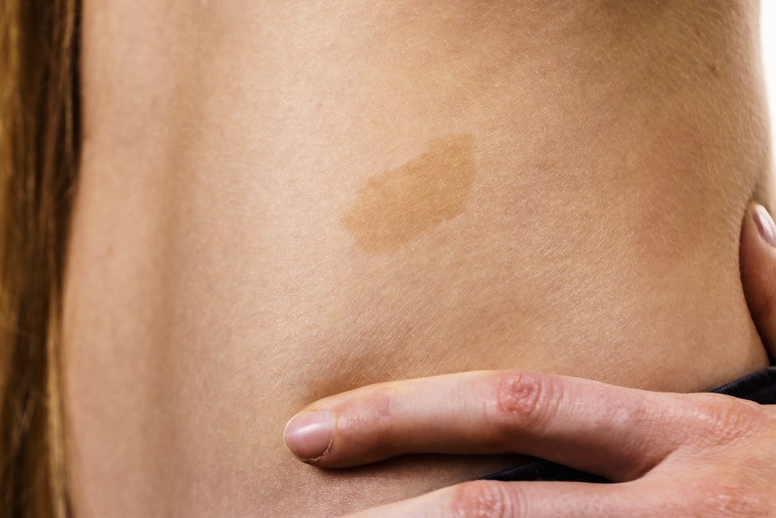 placeholder image-sq